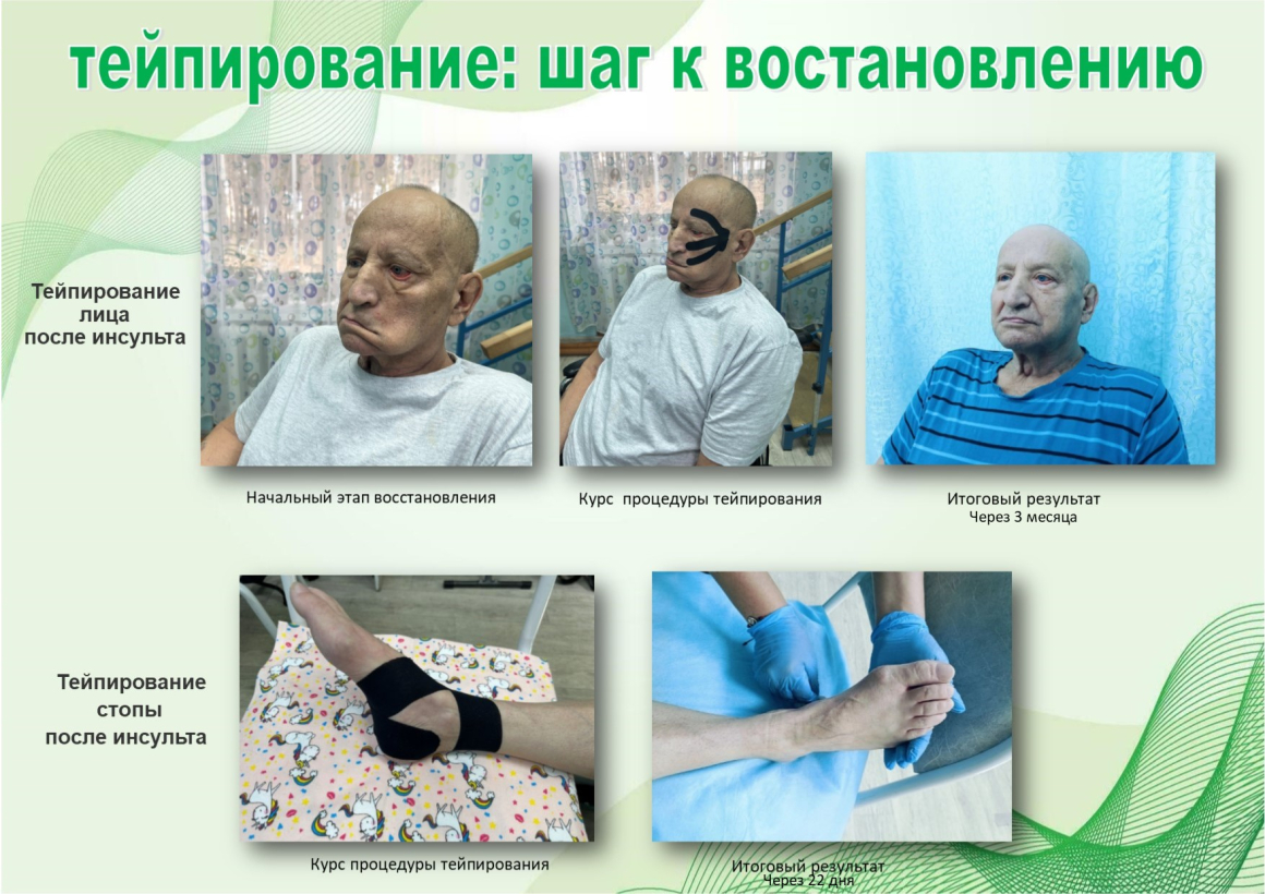 ТЕЙПИРОВАНИЕ: ШАГ К ВОССТАНОВЛЕНИЮ